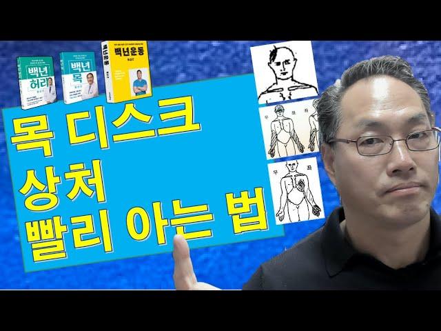 목 디스크 상처 빨리 아는 법 (백년목 기초편#1 연관통)