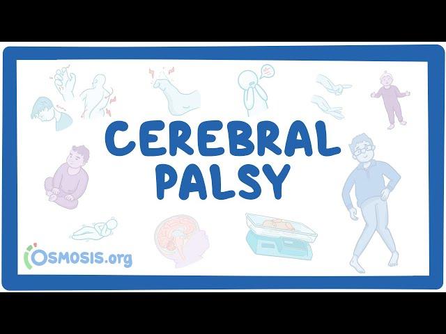 Cerebral palsy (CP) - causes, symptoms, diagnosis, treatment, pathology