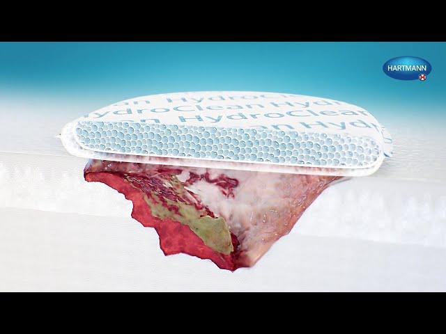 Wound Debridement with HydroClean | Medical Animation