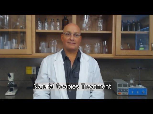 Natural Scabies Treatment | Scabies Treatment the Homeopathic Way with Naturasil