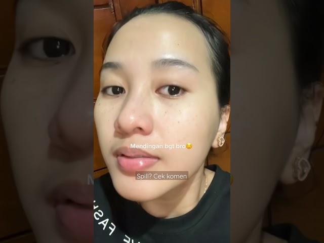 Akibat Rela pakai Merkuri.. Akhirnya Beralih !! #skincareviral