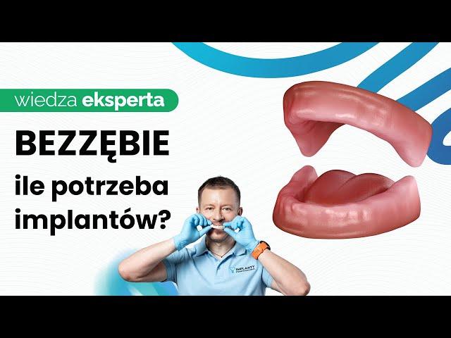 ILE IMPLANTÓW NAPRAWDĘ POTRZEBUJESZ, ABY ODZYSKAĆ PIĘKNY UŚMIECH?