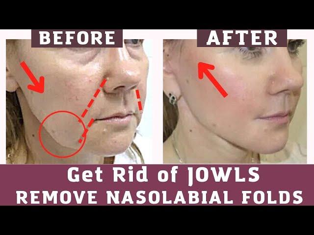 Anti Aging Exercises for Jowls |Nasolabial folds |Smile Lines| face yoga and massage