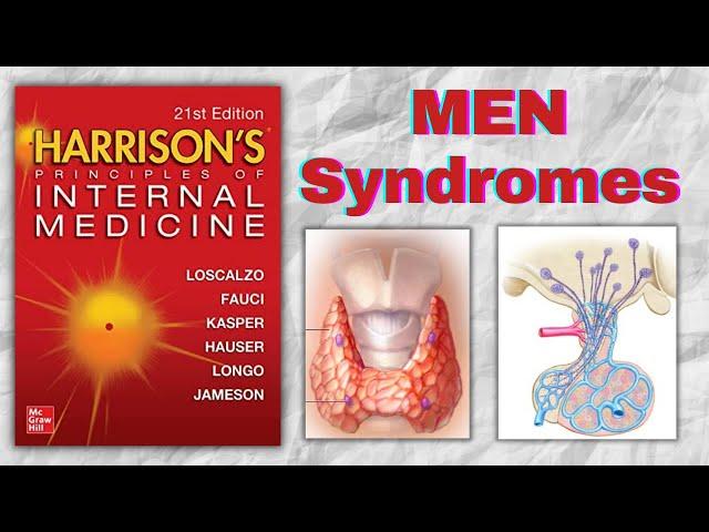 MEN Syndromes | Types | Clinical Features | Genetics | Harrison