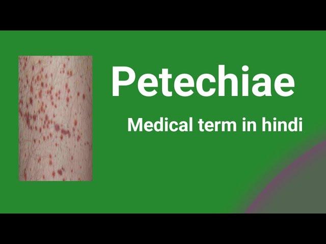 Petechiae/Medical term in hindi