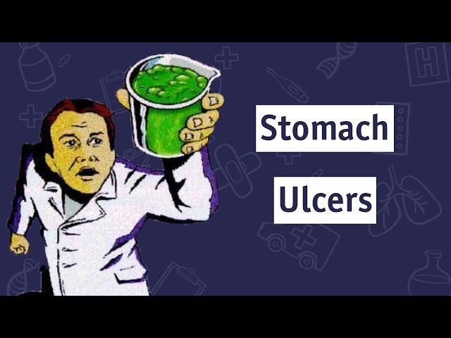 Can You Catch Stomach Ulcers?