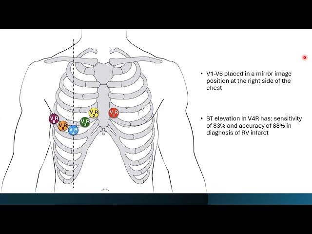 6. Myocardial ischemia Dr omnia