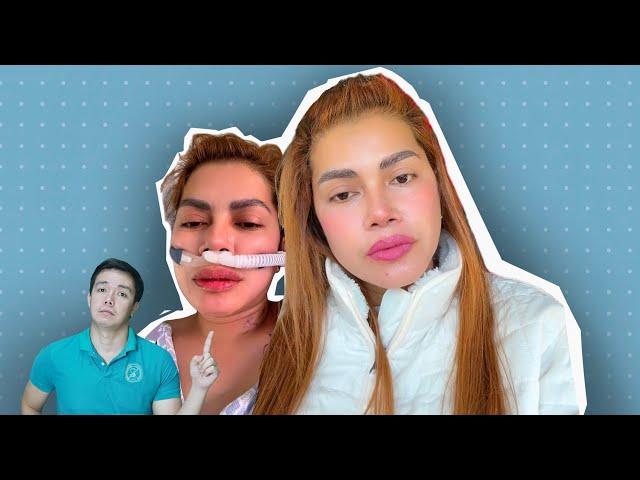 WHAT WENT WRONG KAYA SA LUNG SURGERY NI MERCY SUNOT?