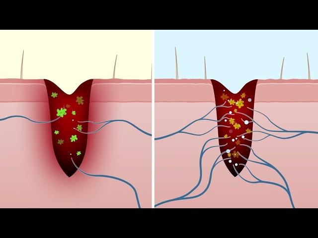 Monash Calcitonin Gene-Related Peptide (CGRP) Animation