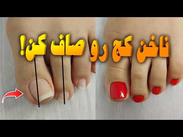 بهترین روش برای اصلاح فرم ناخن کج /سه روش با پلی ژل، پودر و بدون مواد! /روش‌های کاربردی و آسان‌