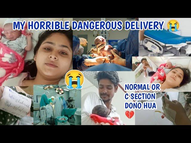 My horrible C-Section delivery Story || 12 hour Real labour pain || Normal Or C section dono hua ?