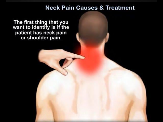 Neck pain causes, symptoms, diagnosis, treatment, Neck pain WHY IT HURTS ? NECK  OR SHOULDER PAIN ?