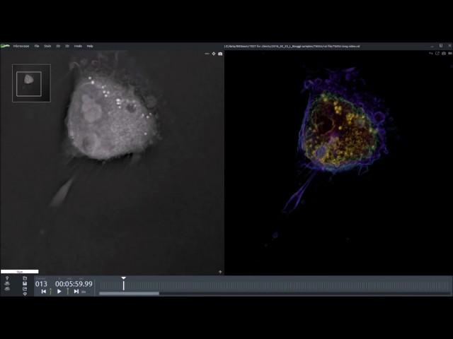 Apoptosis of T685 Human Cancer Cell