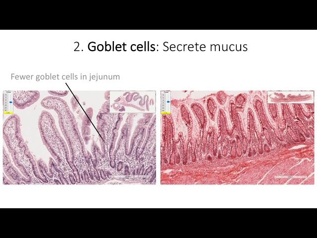 Histology with Chimmalgi: Small intestine