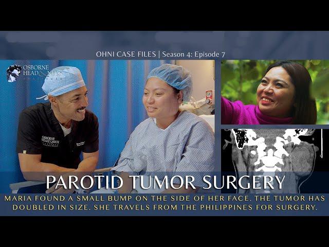 Nursing Student Develops Parotid Gland Tumor