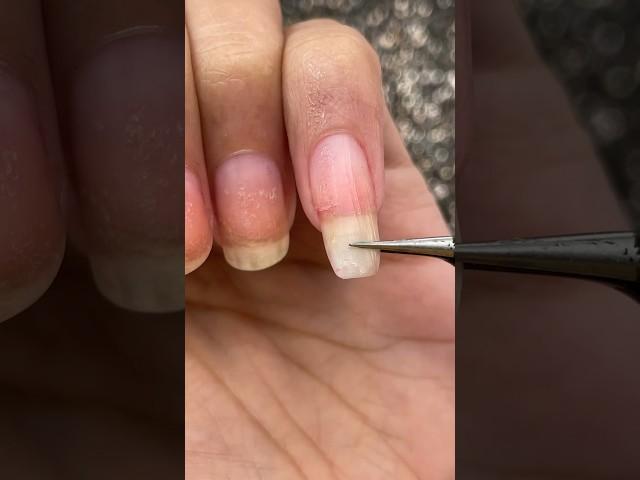 Temporarily Quickly Fixing my "Broken Nail"  Ohhh Noo, Ouchhhh  #nails #nailart #satisfying