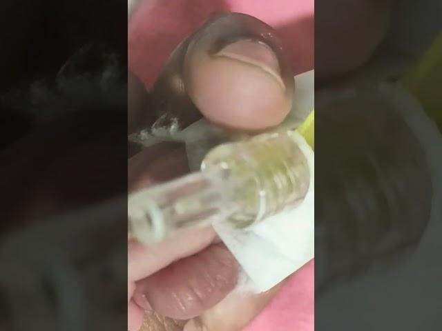 #youtubeshorts #youtube #shot #baby #babycare #nicu #cutebaby #newbornbaby @DrFerdousUSA @dream