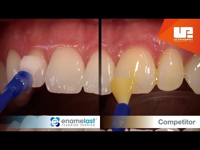 Enamelast™ fluoride varnish vs Competitor varnish