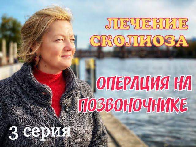 ОГРАНИЧЕНИЕ после ОПЕРАЦИИ на сколиоз 4 степени. Жизнь после операции на сколиоз. 3 Часть.