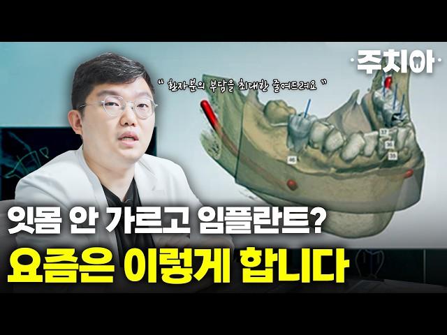 잇몸 안 자르고 임플란트? 환자 부담 줄이는 최신 수술법! (치과의사 주치아)