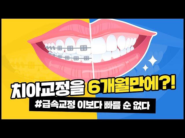 치아교정 2년이나 걸릴 필요 없다고?! 급속교정에 대해서 알아보자! (Let's find out about rapid calibration.)