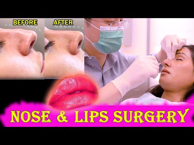 NOSE JOB AND LIPS LIFT | C-LU POKHREL | KK GOLDIE | #VLOG_36