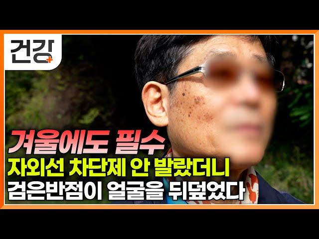 검버섯인 줄 알고 그냥 방치했는데 돌이킬 수 없는 병이 됐다?｜자외선 차단제 바르지 않고 다니는 사람에게 나타나는 공통적인 증상｜올바른 피부 관리법｜명의｜#EBS건강