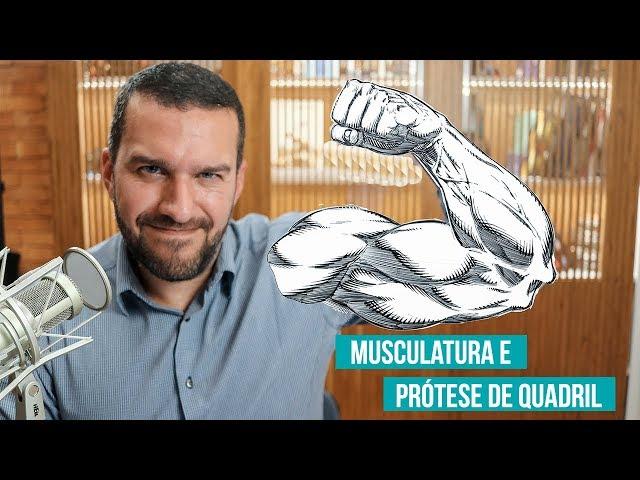 Musculatura antes de uma prótese de Quadril - Dr. David Gusmão