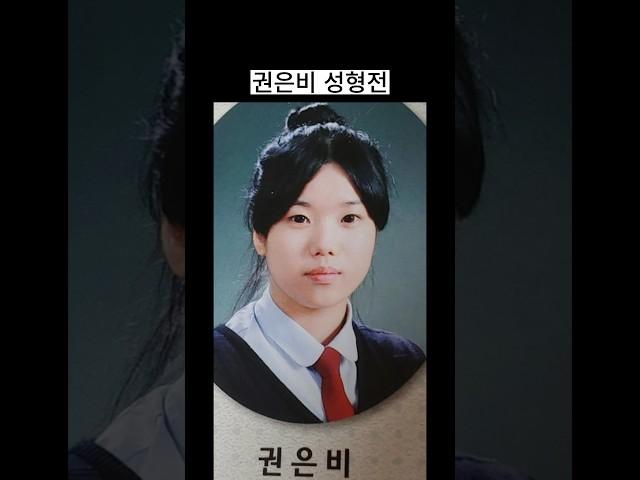권은비 성형전 성형 후