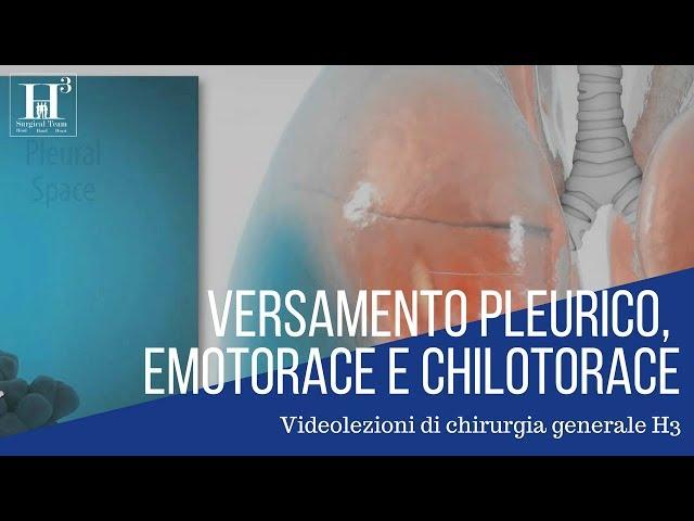 Versamento pleurico, emotorace, chilotorace