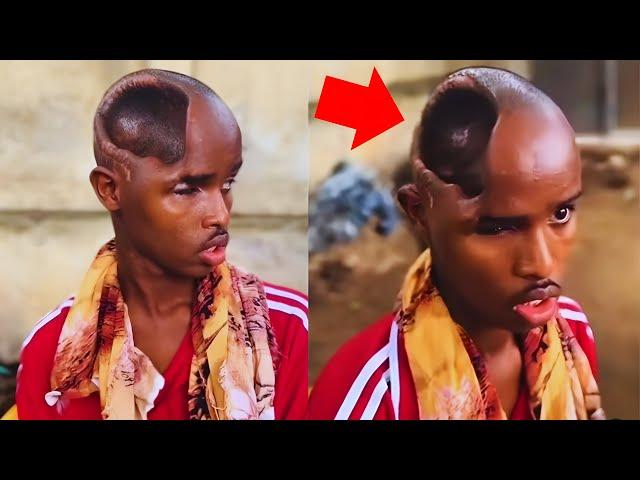 Weird But True: Strange Human Body Parts That’ll Shock You!