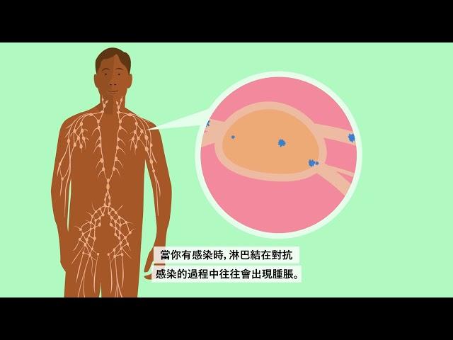 What is cancer? (Chinese Traditional) | 甚麼是癌症？繁體中文| Macmillan Cancer Support