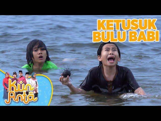 NGERII!!! Berenang Dilaut Sobri Terkena Bulu Babi - KUN ANTA