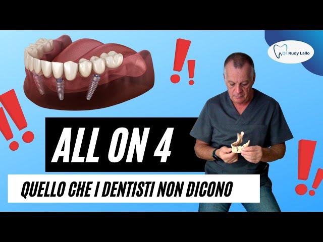 All on Four: quello che i Dentisti Non Dicono.