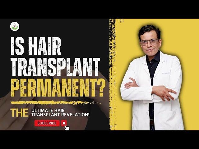 Is Hair Transplant Surgery Permanent? - Dr. Sandeep Bhasin | Care Well Medical Centre