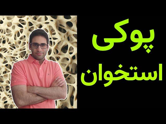 از پوکی استخوان چه می دانید؟- پوکی استخوان چه عوارض و چه علایمی دارد؟