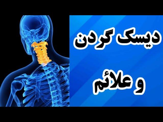 دیسک گردن و علائمی که نادیده میگیریم / دکتر نکته