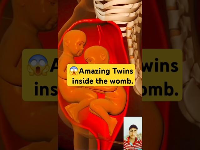 Amazing Twins inside the womb.(3D Animation)