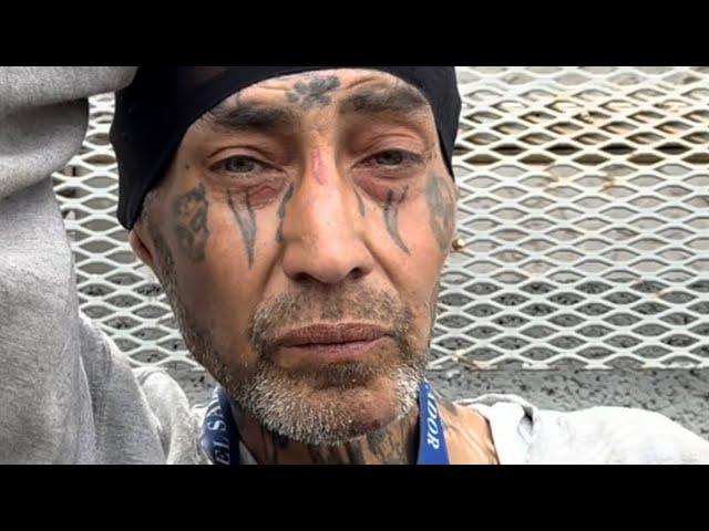 Alfred 52 Lost In Phoenix & Lost His Hand 1 Year Ago