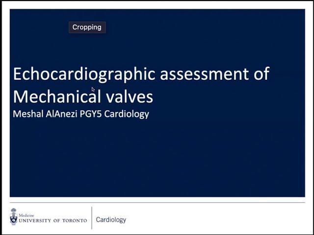 Title:  Echocardiographic Assessment of Mechanical Valves