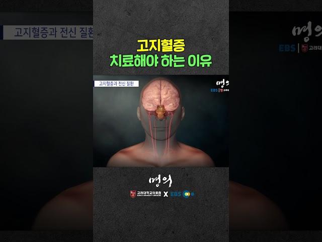 고지혈증 치료 안하면 어떻게 될까?