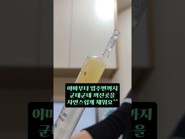 콜라움 콜라겐주사 한달 후기 #청담피부과 #스킨부스터 #콜라움 #콜라겐주사 #청담동피부과 #셀프시술 #김수연원장 #메디컬스킨케어 #리쥬란 #프라이빗피부과