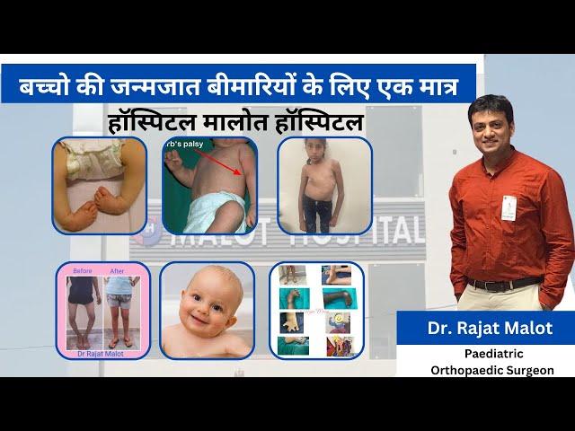 बच्चों के हड्डी व जोड़ रोग के लिए संपर्क करें।  Best Pediatric Orthopedic Hospital Malot Hospital