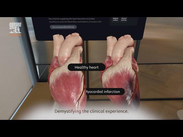 Complete HeartX – discovering the ins and outs of a myocardial infarction