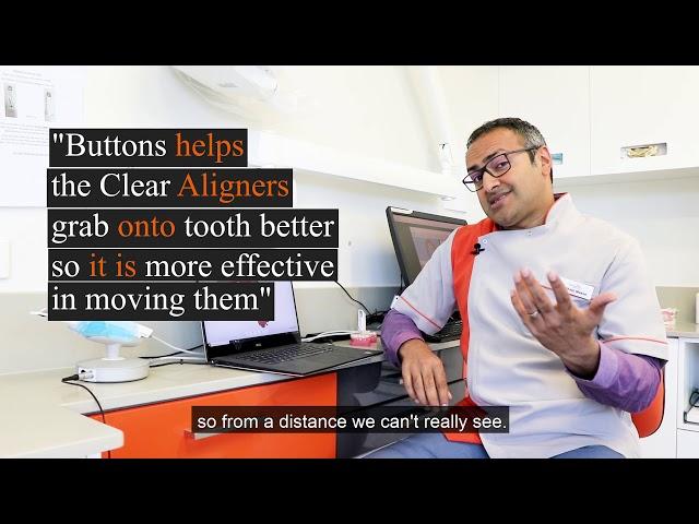 What is the process of Clear Aligners?