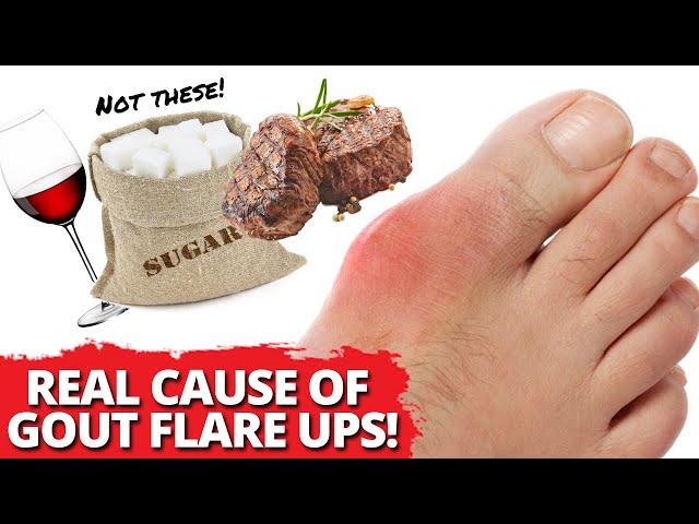 FINALLY Experience FOOD FREEDOM From Gout Attacks.. The REAL Cause Revealed!