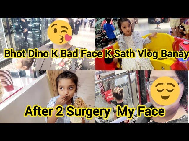 After second surgery my face /bhot dino k bad face k sath vlog banaya/Saima Vlog