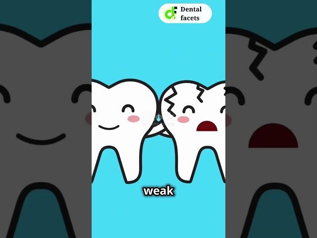 Dental Crowns Explained with a Twist! - [ Dental Facets ] #facts #dentalcare #oralcare