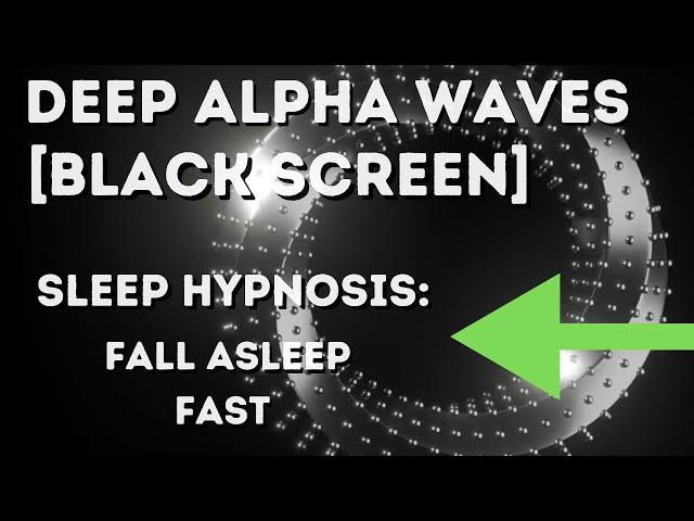 [Sleep Hypnosis]  Alpha Waves For Deep Sleep  》Anxiety Relief, Fall Asleep Fast!  》Sleep Meditation