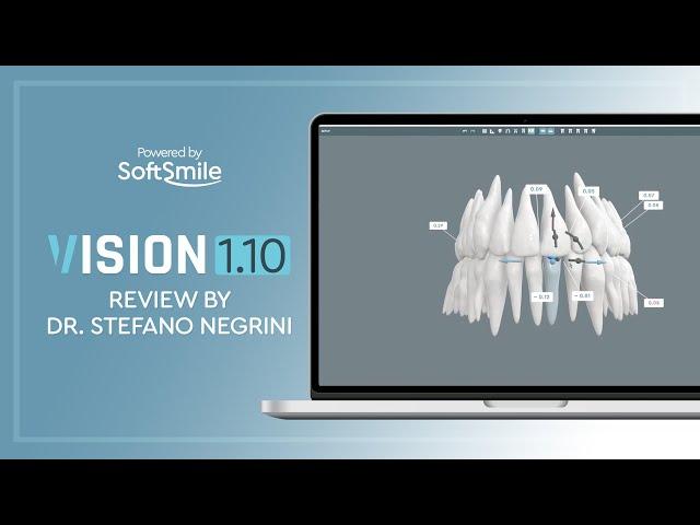 VISION 1.10 Review by Dr. Stefano Negrini